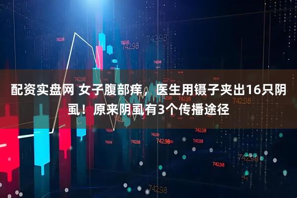 配资实盘网 女子腹部痒，医生用镊子夹出16只阴虱！原来阴虱有3个传播途径